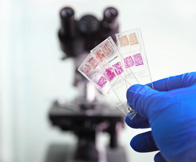Glass slides in the laboratory Glass slides in the laboratory